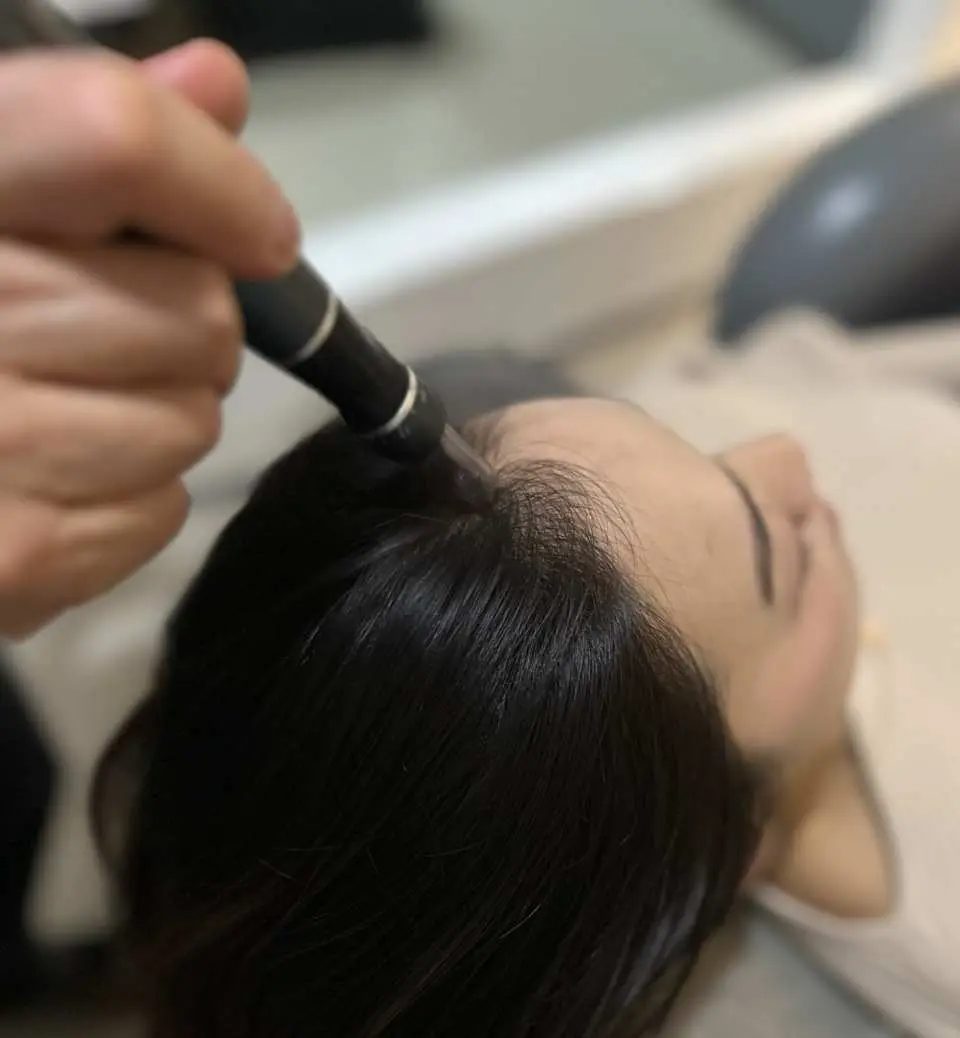 Smart Graft Hair Transplant