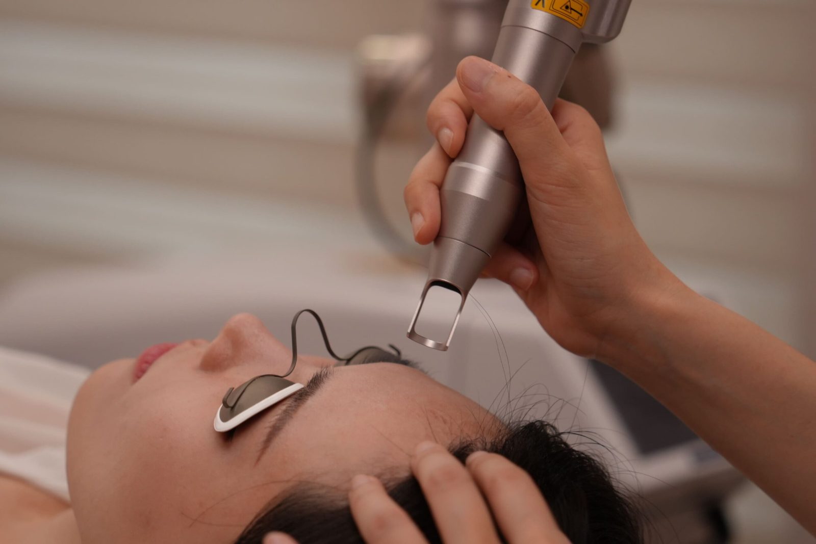 Pico Laser Spot Removal